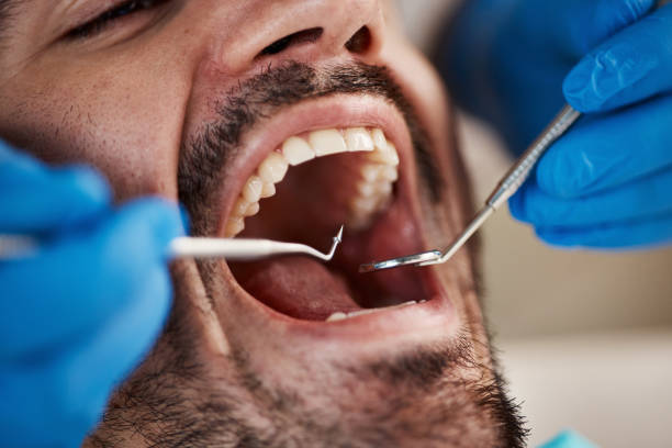 Best Walk-In Emergency Dental Services in Buda, TX